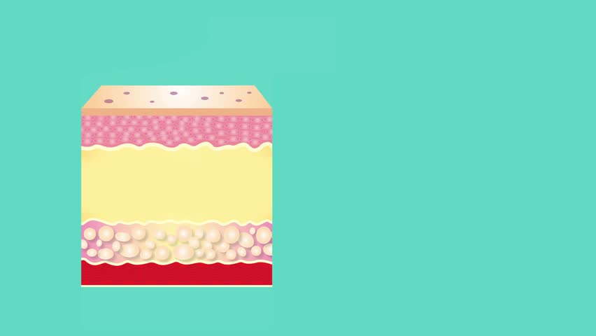 The diagram of younger skin and aging skin showing the decrease in collagen and broken elastin in older skin - 2D animation