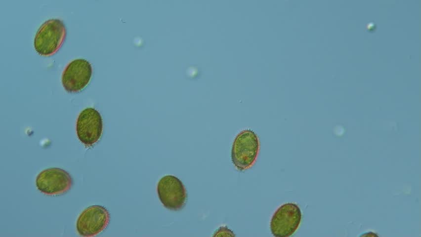 Algal bloom: the green alga Trachelomonas in a water droplet from freshwater