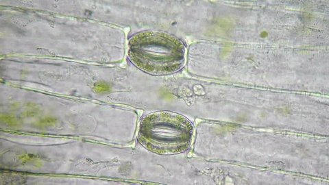 Plant cells, chloroplasts and stoma under microscope, magnification 400X
