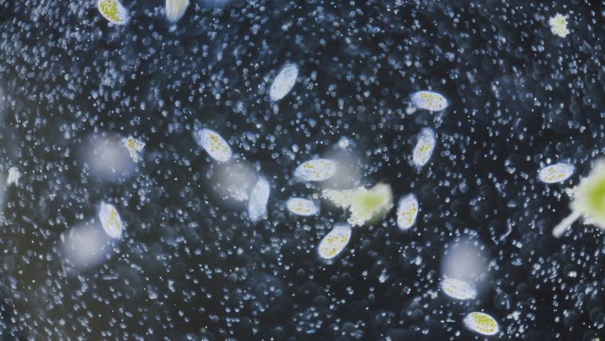 Single-celled paramecium with symbiotic alga inside