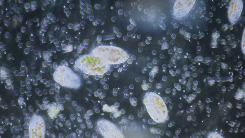 Single-celled paramecium with symbiotic alga inside