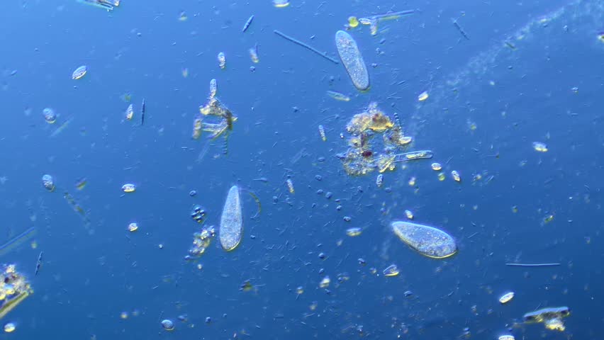 bacteria and other microorganisms under the microscope at 100x Magnification