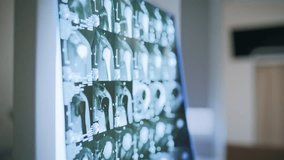 Dedicated medical specialist checking x-ray scans in clinic setting before appointment closeup. Female doctor reviewing radiology results independently. Radiologist performing accurate diagnosis alone - Powered by Shutterstock - Get 15% off with code: PIKWIZARD15