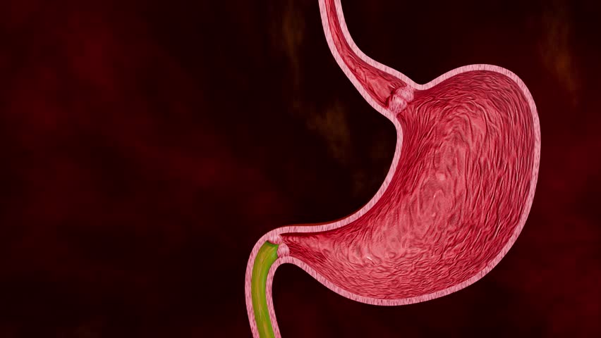 Digestive System Pathology Illustration Featuring Gastric Ulcer Injury, Stomach Tissue Abnormality and Cancer Risk Concept 3D Rendering
