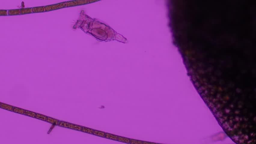 Microscopic video of a rotifer (Brachionus plicatilis) recorded at 100x magnification using phase-contrast microscopy.
This footage reveals the internal anatomy and natural behavior of a planktonic rotifer with enhanced contrast, allowing clear visualization of transparent internal structures. The rotating ciliated corona, used for locomotion and feeding, is distinctly visible. Brachionus plicatilis is a well-known zooplankton species found in freshwater and brackish environments and is widely used in scientific research, aquaculture, and ecological studies.
Captured using phase-contrast illumination, the video highlights the fine structural details and dynamic organization of microscopic animal life, making it ideal for educational materials, scientific documentaries, biology presentations, and nature-focused media projects.