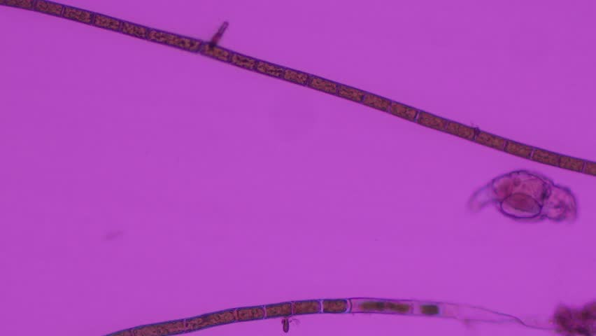 Microscopic video of a rotifer (Brachionus plicatilis) recorded at 100x magnification using polarized light microscopy.
This footage reveals the internal anatomy and natural behavior of a planktonic rotifer through the use of polarized illumination, which enhances the visibility of birefringent and structurally ordered components. The rotating ciliated corona, responsible for locomotion and feeding, can be observed in motion. Brachionus plicatilis is a well-known zooplankton species found in freshwater and brackish environments and is widely used in scientific research, aquaculture, and ecological studies.
Captured with polarized light, the video emphasizes structural organization and optical properties within microscopic animal life, making it suitable for educational materials, scientific documentaries, biology presentations, and nature-focused media projects.