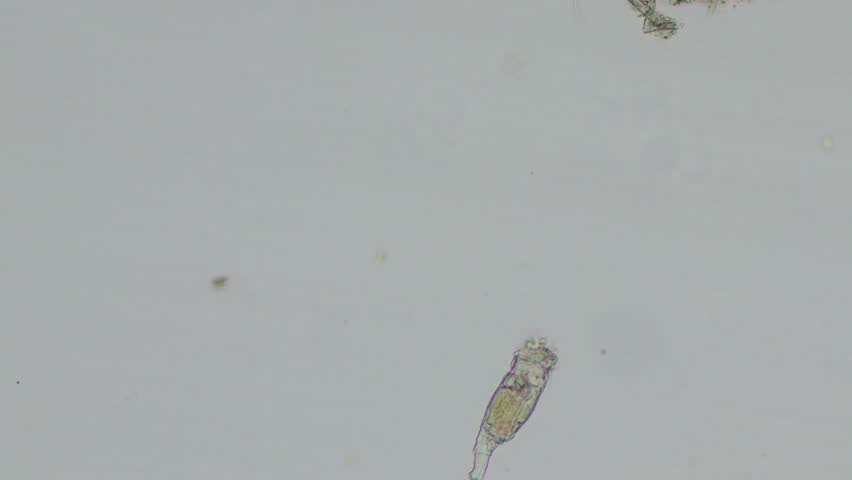 Microscopic video of a rotifer (Brachionus plicatilis) recorded at 100x magnification using bright-field microscopy.
This footage reveals the internal anatomy and natural behavior of a planktonic rotifer, including its rotating ciliated corona used for locomotion and feeding. Brachionus plicatilis is a well-known zooplankton species found in freshwater and brackish environments and is widely used in scientific research, aquaculture, and ecological studies.
Captured in bright-field illumination, the video clearly demonstrates the structural complexity of microscopic animal life, making it ideal for educational materials, scientific documentaries, biology presentations, and nature-focused media projects.