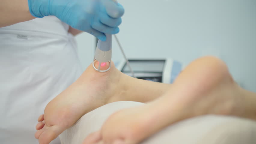 Laser physiotherapy treatment applied to patient foot