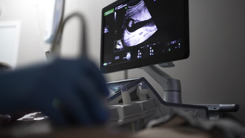 Obstetrician operating an ultrasound machine, examining a fetus on the monitor during a prenatal checkup for a pregnant woman in a modern clinic, focusing on the screen and doctor's hands