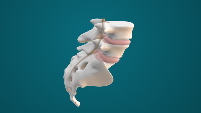Sciatic Nerve Pain in Lower Back