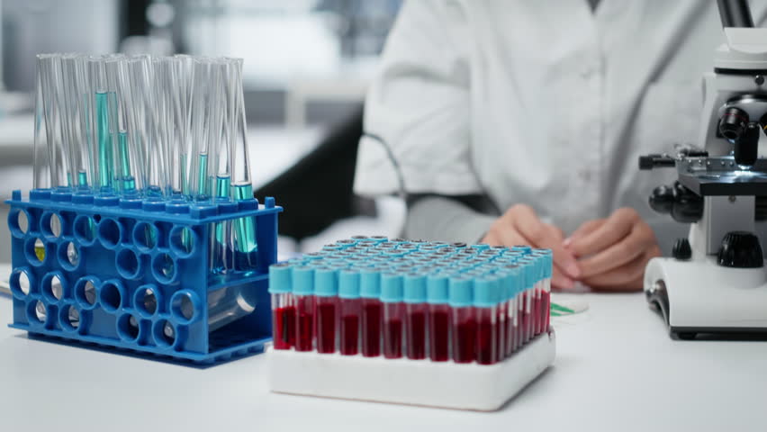 Laboratory expert analyzing batch of blood samples for disease research clinical testing. Female scientist in lab doing research on sanguine fluid vials for testing, camera B