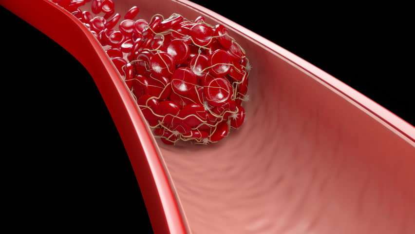 blood clots, narrowed arteries, and cardiovascular disease.
