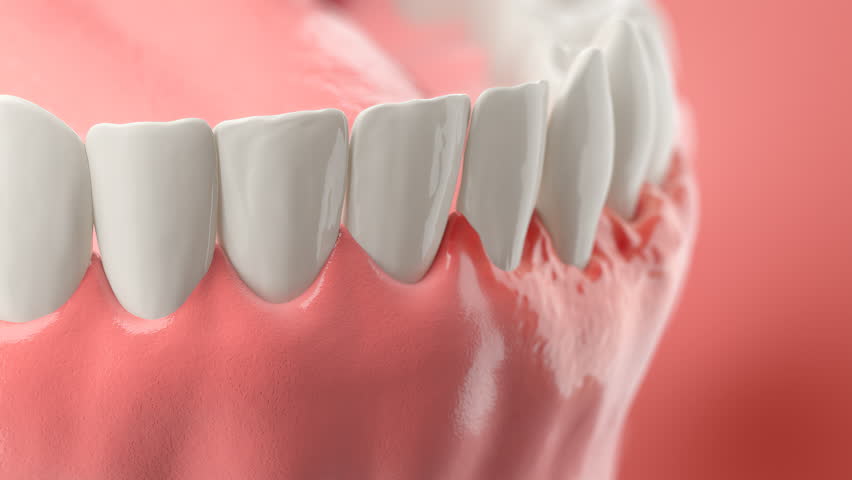 Teeth and oral health demonstrating treatment for gum disease and inflammation with herbal gel.