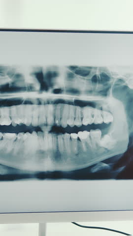 The dentist examines a panoramic x-ray of the teeth. The dentist shows the problem teeth on the X-ray of the teeth with his finger.