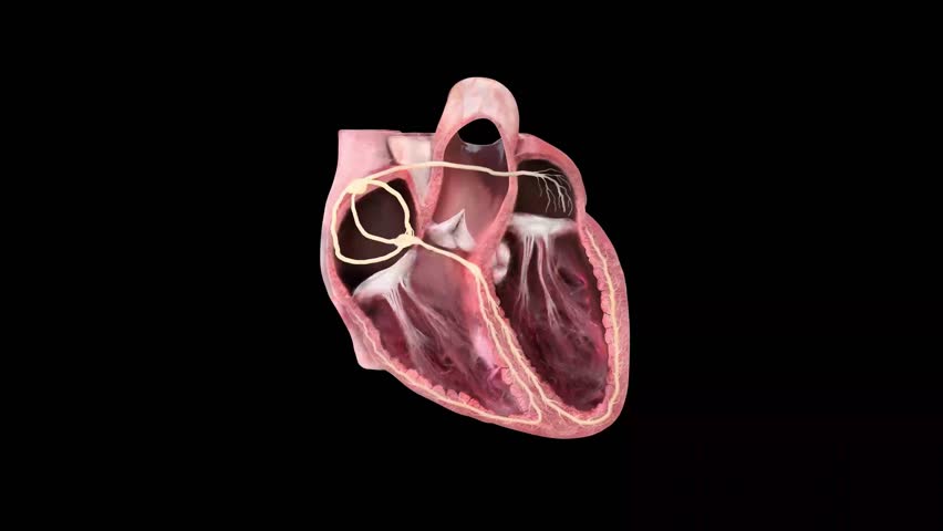 Human Heart Pathology 3D Medical Illustration Showing Cardiac Structure, Electrical Routes and Clinical Diagnostic Anatomy