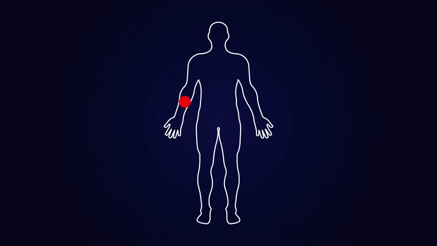 Human Silhouette Illustration Showing Right Arm Pain Point With Red Circle and Concentric Rings