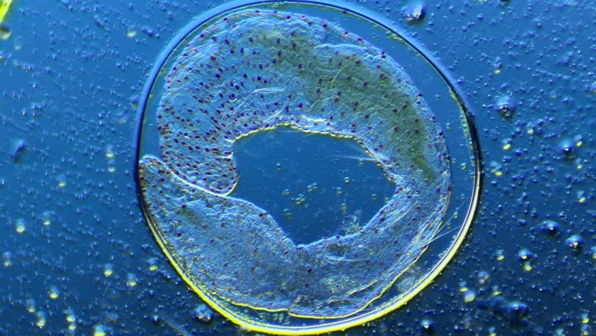 Annelid worm Aeolosoma reproducing by fragmentation under the microscope at 100x Magnification