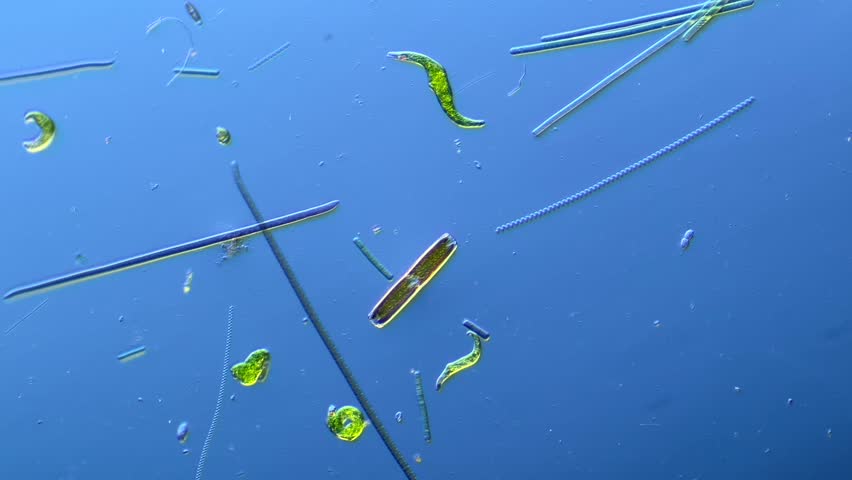 Euglenids and other microorganisms under the microscope at 100x Magnification