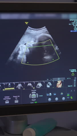 Ultrasound screen showing baby during prenatal checkup. Pregnancy healthcare, early motherhood, baby development and medical diagnostics concept.