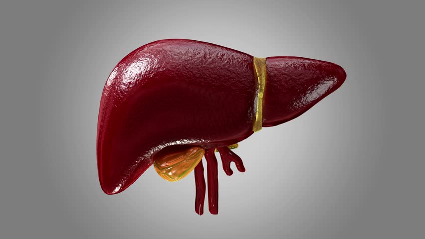 Fatty liver disease and liver cancer concepts illustrate the anatomy of a damaged human liver with abnormal tissue or lumps of fat. for medical education and 3D healthcare perception render.