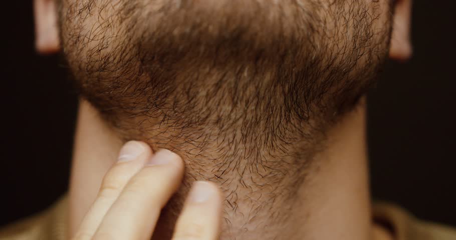 Close-up of a man’s unshaved beard and neck without clean contours. Concept of grooming, personal care, beard growth, masculinity, and everyday appearance.