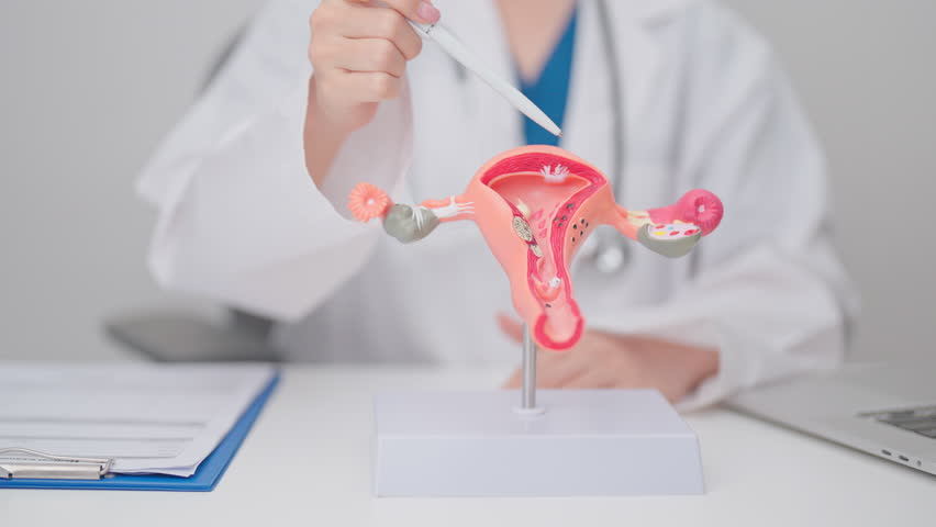 Doctor with Uterus and Ovaries anatomy model. Ovarian and Cervical cancer, Cervix disorder, Endometriosis, Hysterectomy, Uterine fibroids, Reproductive system, Pregnancy and health concept