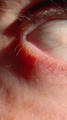 Detailed Closeup Of Eye Textures. Photograph Capturing Fine Textures And Vibrant Colors Of Eye. Highly Detailed Image Focusing Intensely On Complex Textures And Hues Of Eye