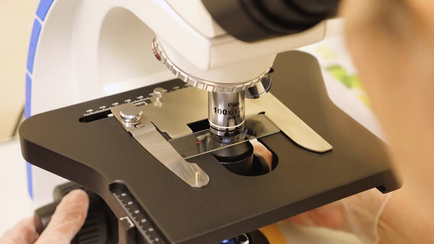 Laboratory technician adjusting focus on microscopic slide carefully. Research scientist meticulously examining specimen using advanced microscopy techniques in clinical setting