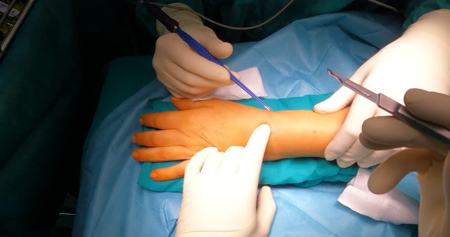 A high-angle, close-up shot of surgeons' gloved hands performing a precise surgical procedure on a patient's wrist and hand in a professional medical setting.