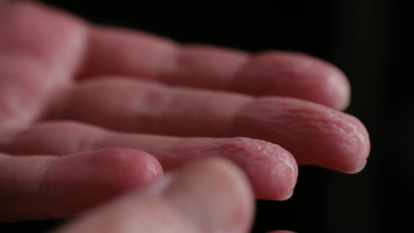 Macro view of pruney fingers returning to their natural state after prolonged water exposure, showing the skin texture gradually smoothing out and the wrinkles on the fingertips disappearing