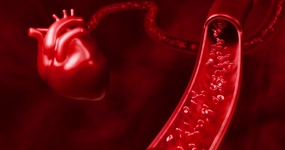 Artery clogged by unhealthy junk food, sugary drinks, and alcohol, illustrating serious cardiovascular risks, atherosclerosis, and heart disease problems in human blood vessels. 3D rendering.
