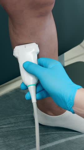 Medical specialist performing ultrasound scan of leg veins using diagnostic probe during vascular examination in clinic.