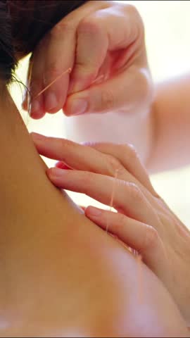 A close-up shot shows an acupuncturist carefully inserting a thin needle into a patient