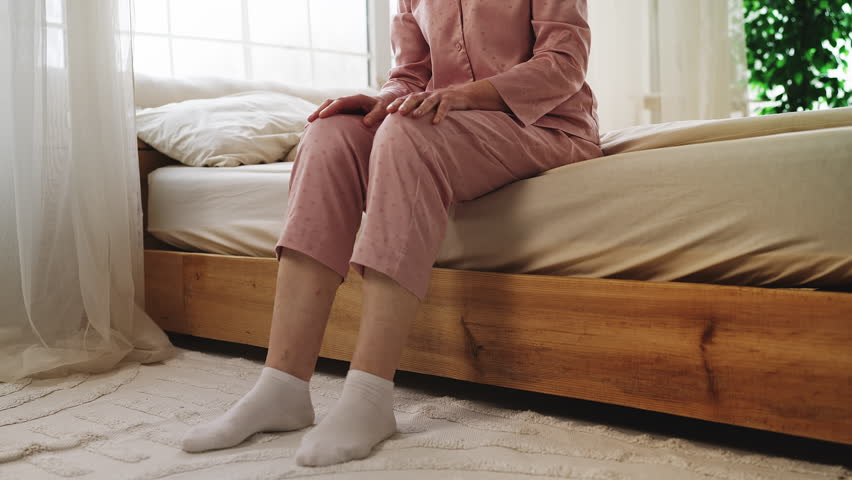 Elderly woman rubbing swollen legs while sitting on bed, varicose veins, cramps