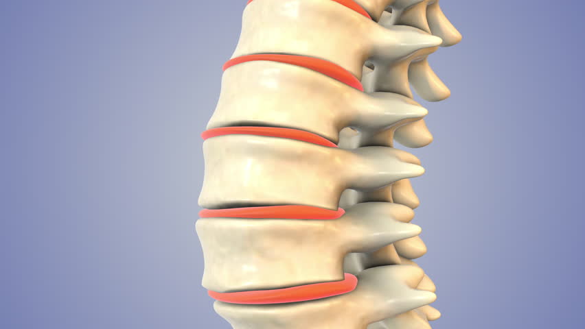 Lower Back Disc Herniation and Sciatica Pain