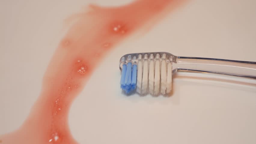 Close up of a toothbrush lying in a bathroom sink with traces of blood. Concept of dental issues, oral hygiene problems, and health concern. High quality 4k footage