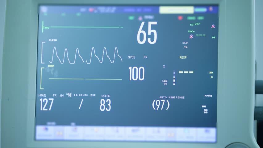 Panning shot of patient monitor displaying changing vital signs at hospital bedside in icu with slow horizontal tracking movement.