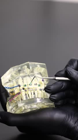 Orthodontic ligature removal from bracket using dental probe typodont