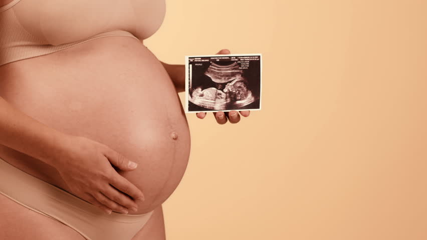 Expecting Mother Holding Ultrasound Image of Her Baby During Pregnancy at Home