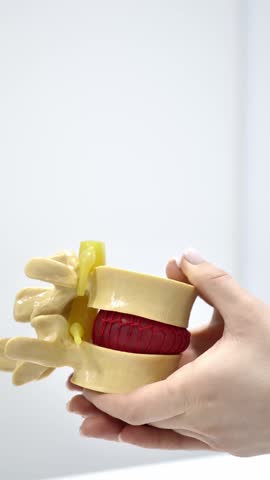 Close-up of a neurologist holding a human vertebrae anatomical model showing a red intervertebral disc herniation. Concept of back pain and treatment