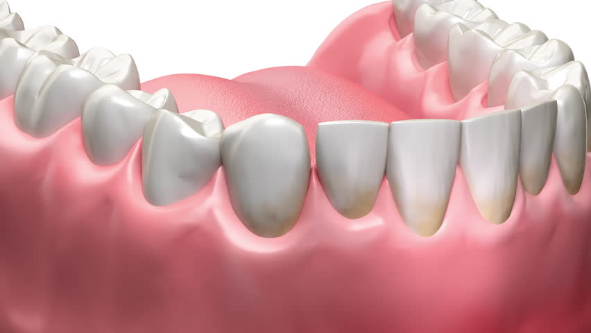 3d animation of teeth and oral health showing gum disease and inflammation.