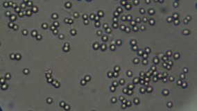 Cells under a microscope extreme macro Blood under a microscope shows individual blood cells flowing through plasma Laboratory analysis for disease detection biologist working - Powered by Shutterstock - Get 15% off with code: PIKWIZARD15