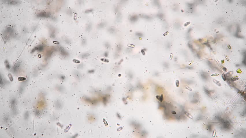 Organic sediment particles mixed with microbes under microscope, fine detritus and warm tones suggest decomposition environmental scientist measuring sediment load for water quality.