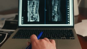 POV of doctor reviewing MRI scans of the spine on a laptop in a medical office. Healthcare, diagnostics and spinal examination concept. High quality 4k footage - Powered by Shutterstock - Get 15% off with code: PIKWIZARD15