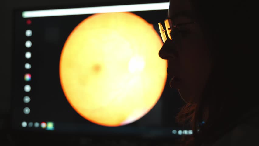 Female doctor in a dimly lit office analyzing a digital image of a human fundus on a computer monitor, pointing at the screen to indicate a specific area during a diagnostic examination