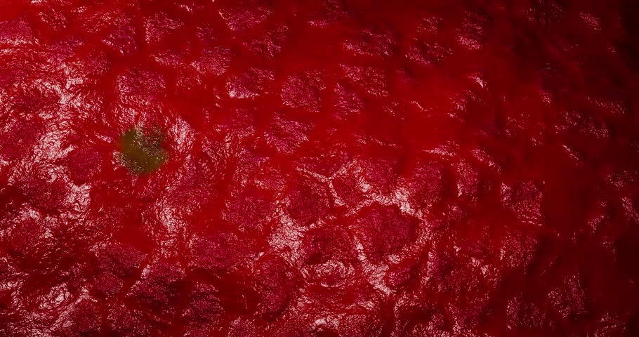 Human Cancer Cell Invading Surrounding Tissue Through Extensive Tumor Network Illustrating Malignant Growth, Cellular Proliferation, Metastasis, Angiogenesis, and Oncology Medicine 3D Rendering
