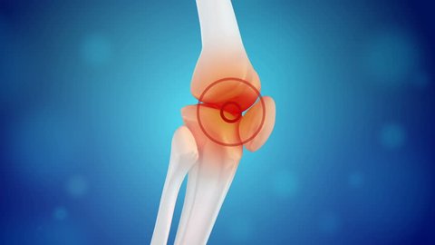 Knee pain animation