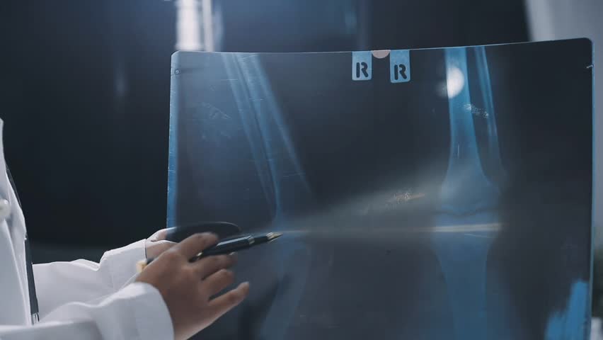 Thoughtful doctors having meeting in hospital
