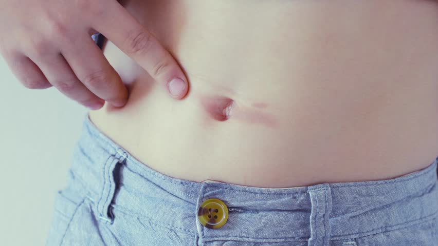 Child lifts his shirt to reveal his stomach and shows an iron burn near his belly button, experiencing pain and discomfort that requires medical attention
