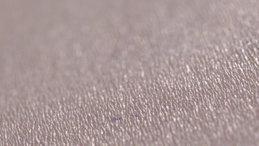 Honey Bee Stinging Human Skin with Visible Stinger Close Up Macro